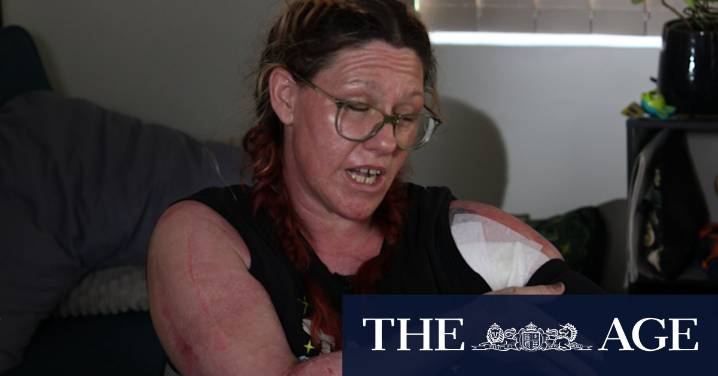 Greenfields firebomb attack: WA mum describes moment she was engulfed in flames