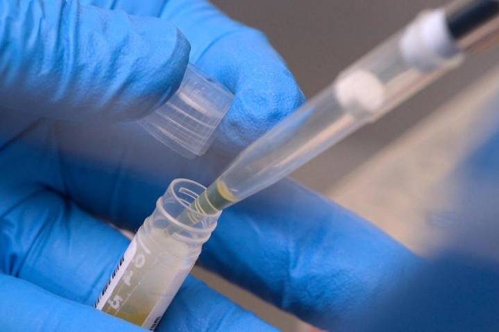 NIH funding cuts affected over 74,000 people in experiments: report