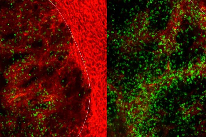 Descubren por qué el cáncer de colon es capaz de burlar a la inmunoterapia