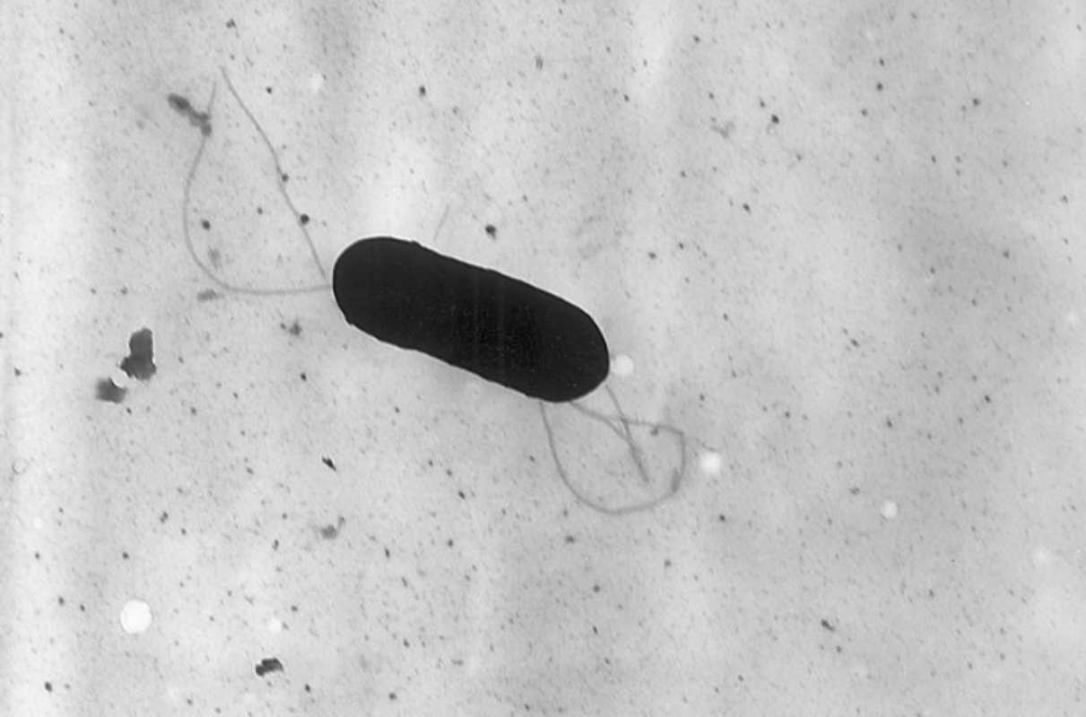 Alertan de la presencia de listeria en queso mezcla distribuido en Castilla