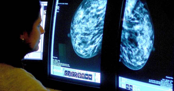 Nearly 1 in 10 American adults say they've received a cancer diagnosis