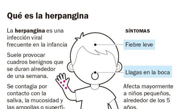 Alerta estacional: resurge la enfermedad de boca, manos y pies