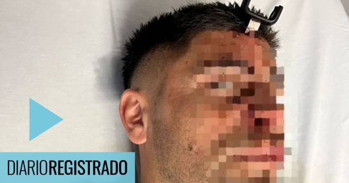 Imágenes sensibles: le clavó una llave en la cabeza a un exfutbolista por una pelea en un torneo de fútbol