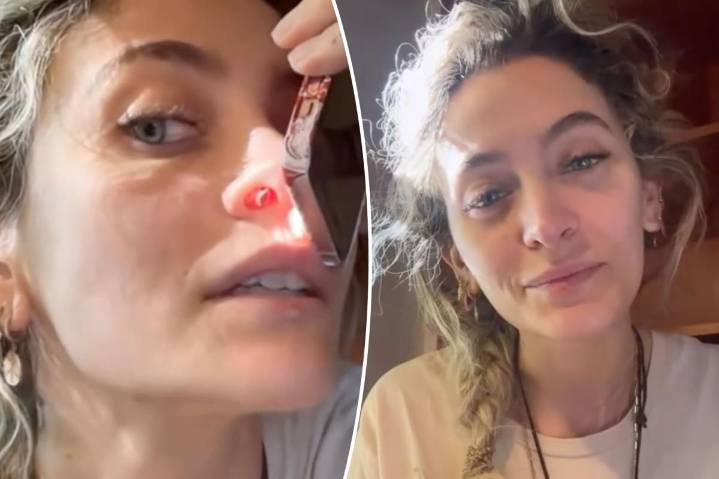EN VIDEO: La impactante confesión de Paris, la hija de Michael Jackson sobre las secuelas físicas que le dejaron sus adicciones