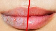 ¿Labios partidos? Este remedio casero los repara y suaviza en horas, según expertos