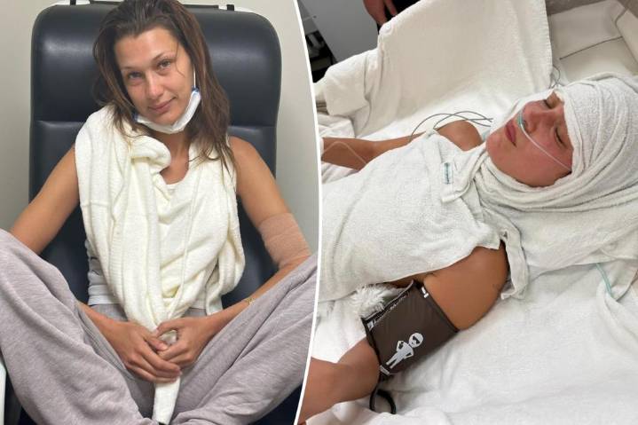 Bella Hadid talks 'medical anxiety' amid Lyme disease battle