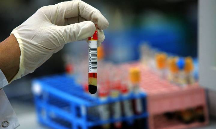 Blood test identifies HPV-associated head and neck cancers up to 10 years before symptoms: Study