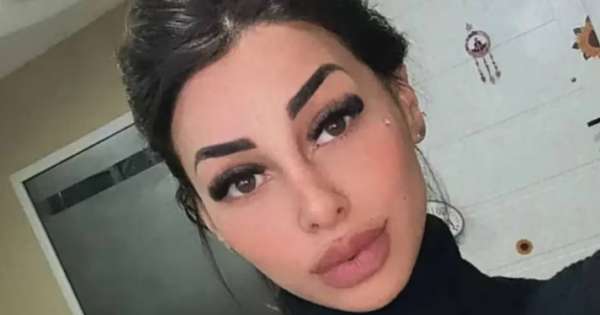 "No lo puedo creer": así quedó la ex de L-Gante tras su retoque estético