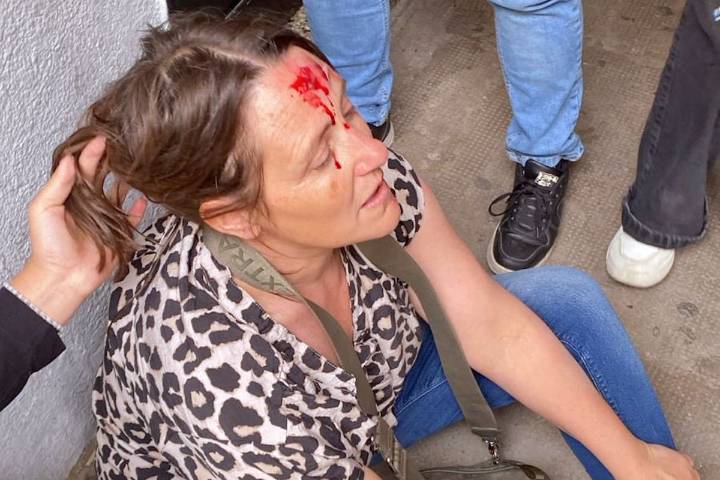 “Hay una ira generalizada”. Una especialista en educación analizó el aumento de la violencia en las escuelas