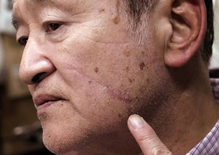 The roar that haunts him: Japanese bear attack survivor calls for ruthless response