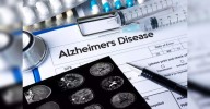 Scientists find brain cells that can stop Alzheimer's: Study