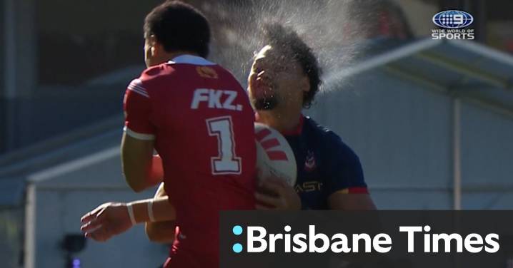 Video: Tonga frightened as star goes down in warm up