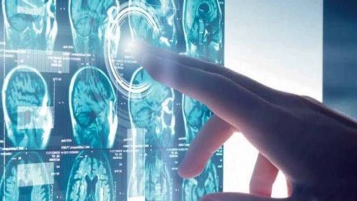 Un estudio hispano-chino abre la vía para tratar el alzhéimer con nanotecnología