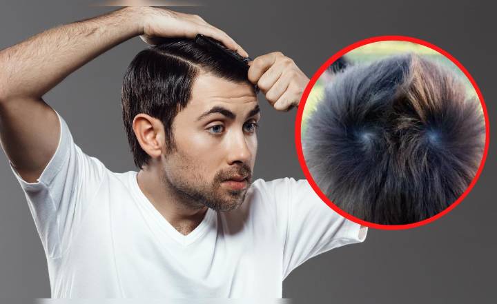 ¿Qué significa tener 1 o 2 remolinos en la cabeza y por qué aparecen?