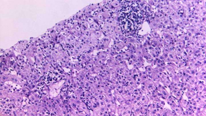 ACIP hep b vaccine, FDA drug vouchers: Morning Rounds