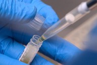 NIH funding cuts affected over 74,000 people in experiments: report