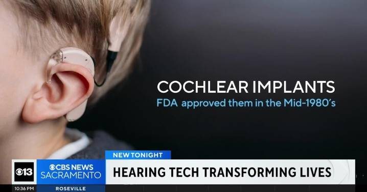 Vietnam veteran regains hearing after decades thanks to cochlear implant