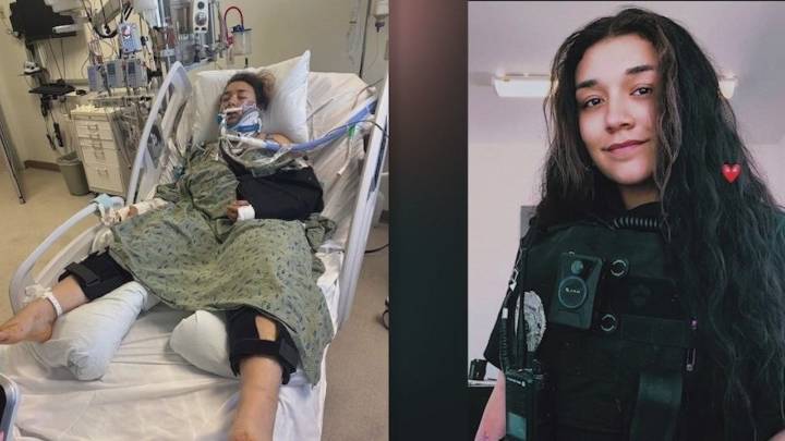 Arizona DPS investigates hit-and-run that left woman in ICU