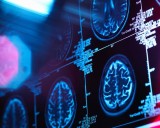 Brain has five ‘eras’, scientists say – with adult mode not starting until early 30s