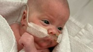 Australia’s youngest-ever premature baby