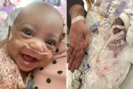 Baby Was the Size of a Soda Can at Birth (Exclusive)