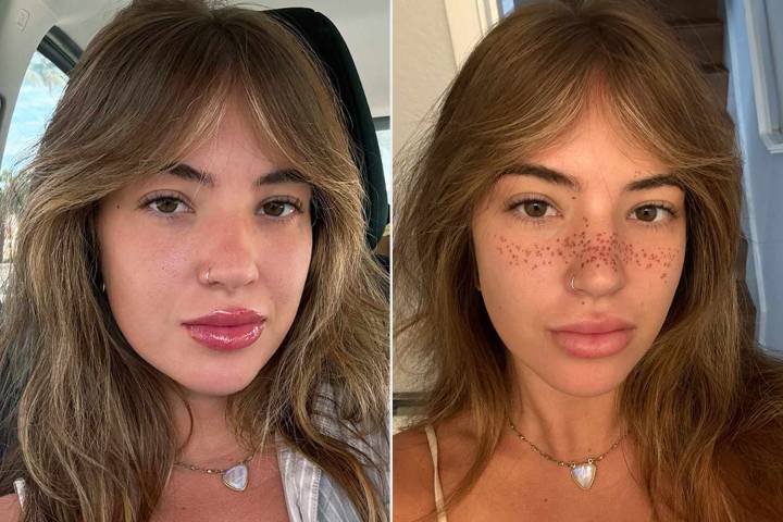 Internet Says Woman 'Ruined' Her Face by Getting Tattooed Freckles (Exclusive)
