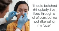 22 Worst Stories Of Botched Plastic Surgeries People Sadly Experienced