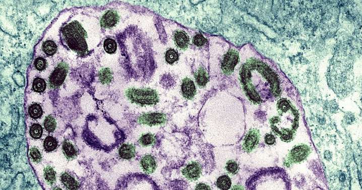 Marbug virus outbreak confirmed in Ethiopia: Africa CDC