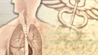 Texas ranks low in key lung cancer metrics, new report finds