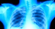 7 Lung Cancer Symptoms A Doctor Monitors In Himself