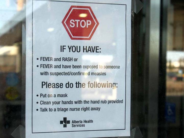 Canada Loses Measles-Free Status With Outbreak Passing One