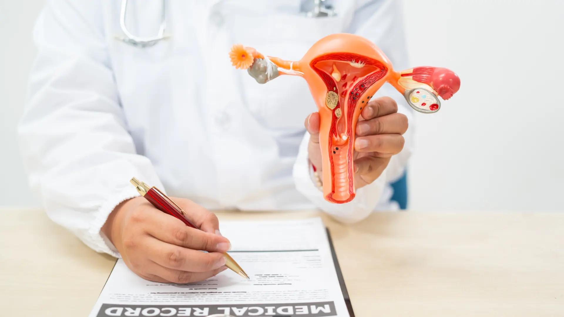 La enfermedad oculta que podría aparecer en las mujeres que han superado un cáncer de cuello uterino