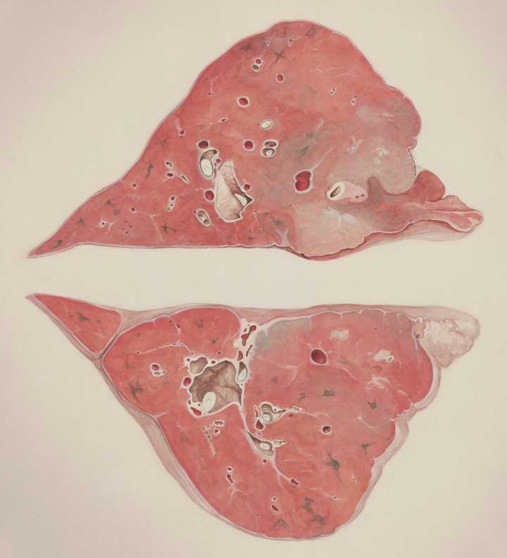 Dangerous Recall After Food Made In New York Found With Organs