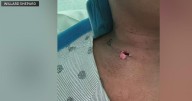 South Florida woman shot in neck speaks out after miraculous recovery: “I thought it would be fata