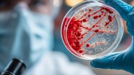 Cómo frenar el avance de las superbacterias en Rosario