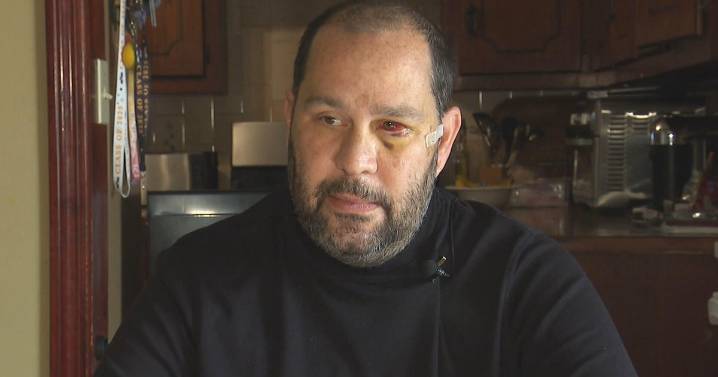 Former Fall River mayor describes moment he was stabbed: "He was telling me to die"