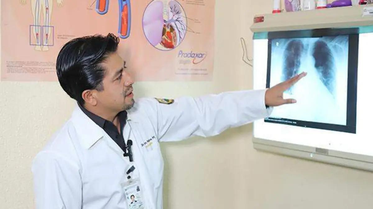 Reportan aumento en casos de neumonía: Se registraron 393 nuevos contagios en sólo dos semanas