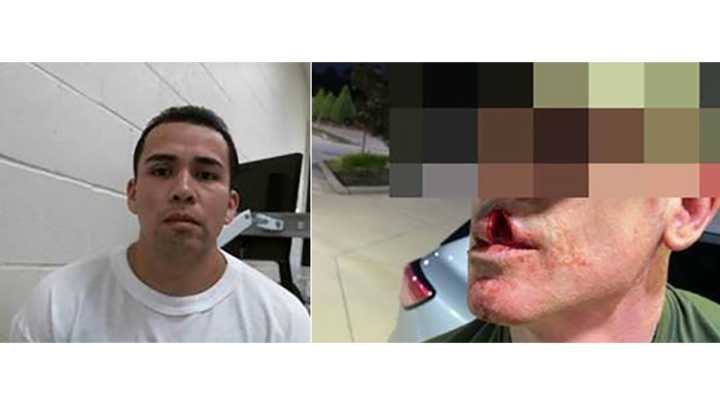 DHS: ICE agent’s face severely injured by detainee amid escalating violence toward officers