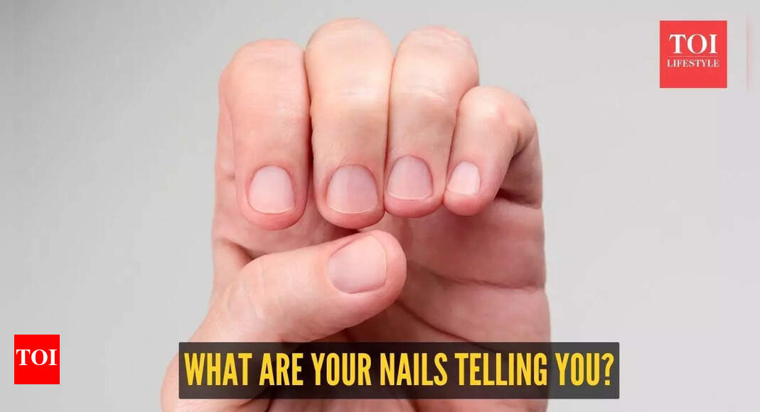 What your fingernails say about your health