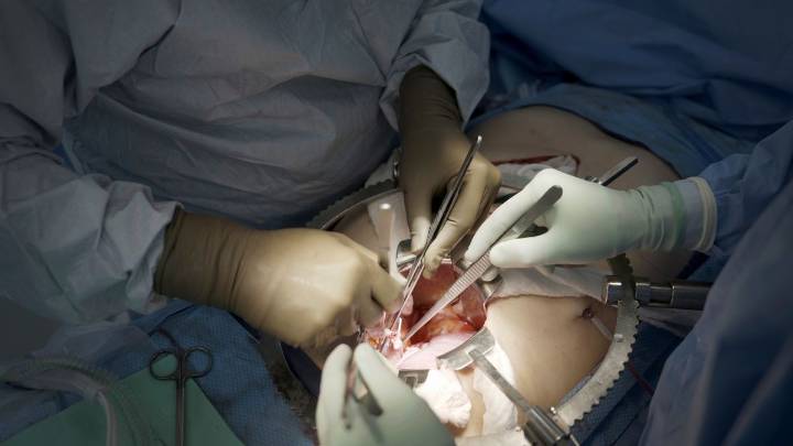 Comienza el primer ensayo clínico de trasplantes de riñón de cerdo