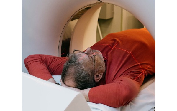 El cáncer más mortal de Estados Unidos presenta tasas de detección pésimas