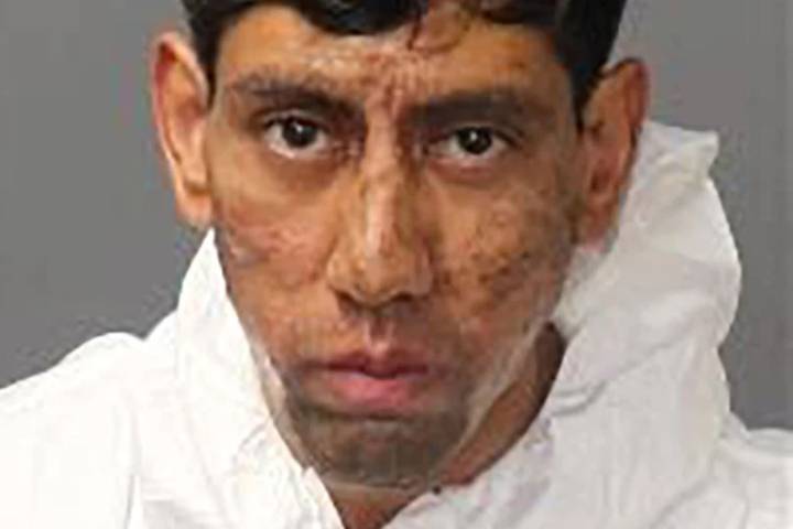 Man Accused of Killing 2 Victims Tells Police Cockroach Made Him Do It