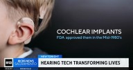 Vietnam veteran regains hearing after decades thanks to cochlear implant