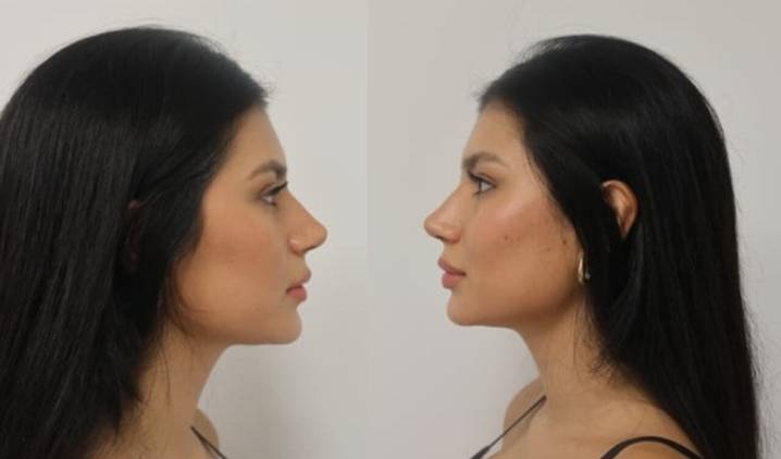 Tendencias en procedimientos estéticos en Zaragoza