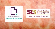 Race on to ID people in contact with first confirmed measles patient in SLCo