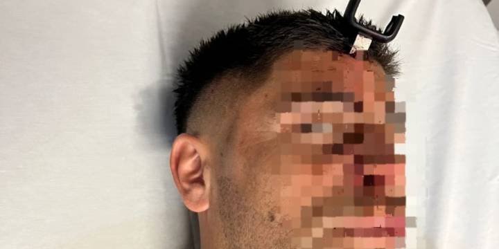 Conmoción en el fútbol: en medio de una pelea, le clavaron una llave en la cabeza a un jugador de General Lamadrid