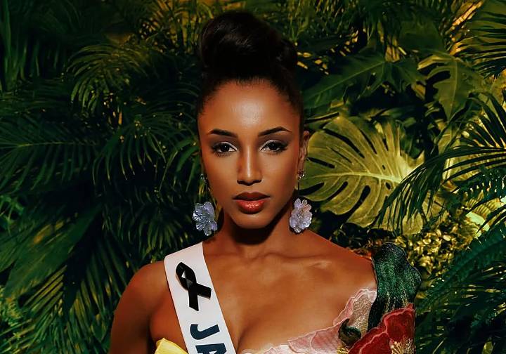 Miss Jamaica permanece en cuidados intensivos