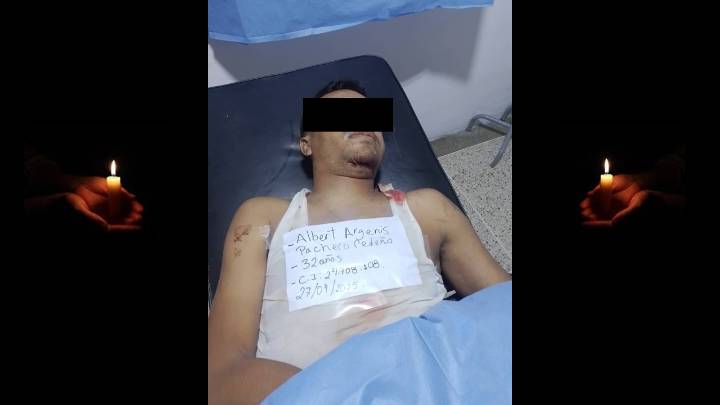 Falleció motorizado en choque de Guara