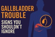 Gallbladder Trouble: 7 Signs You Shouldn’t Ignore — and What to Ask Your Doctor