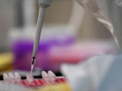 Las infecciones por superbacterias, camino de superar al cáncer como principal causa de muerte